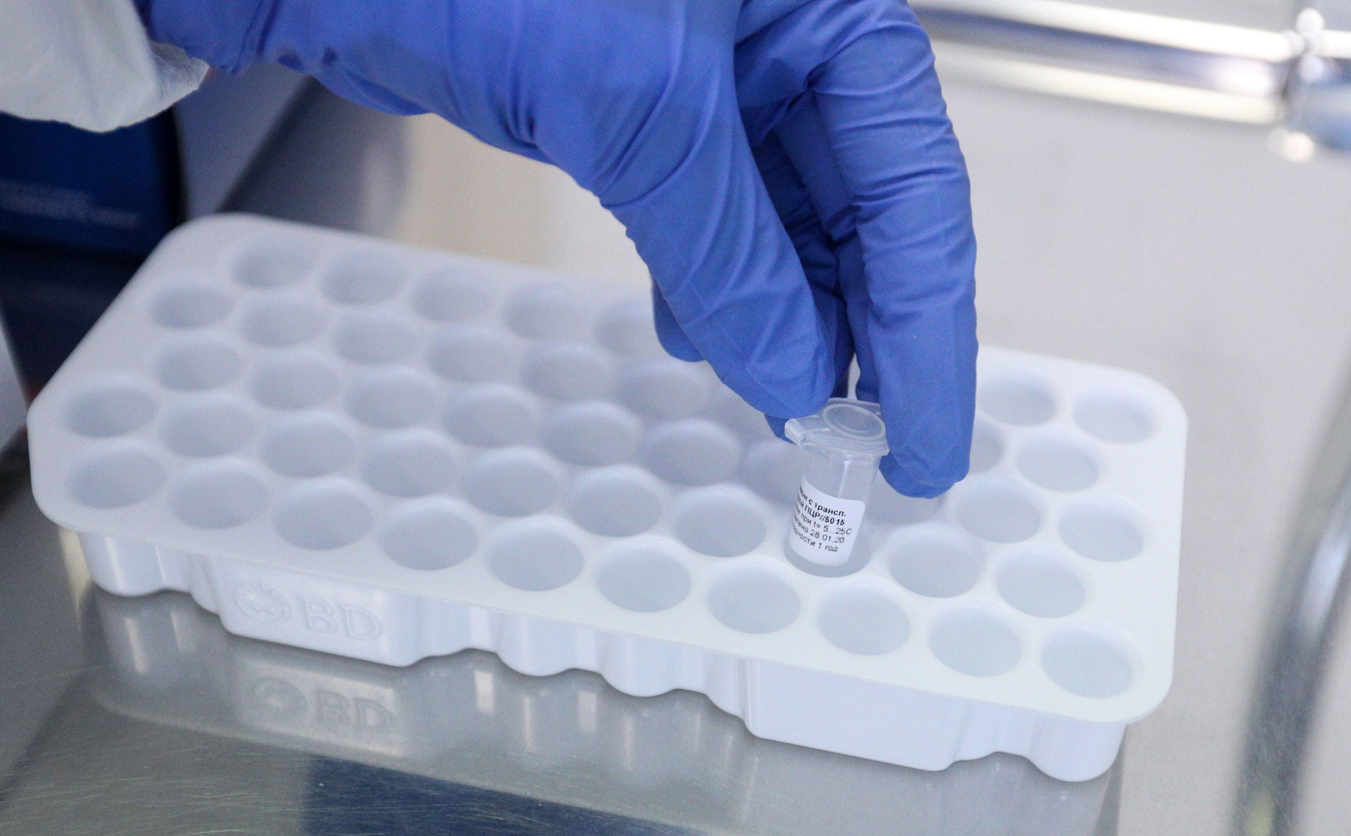 Роспотребнадзор отчитался о 1,5 млн проведенных тестов на коронавирус
