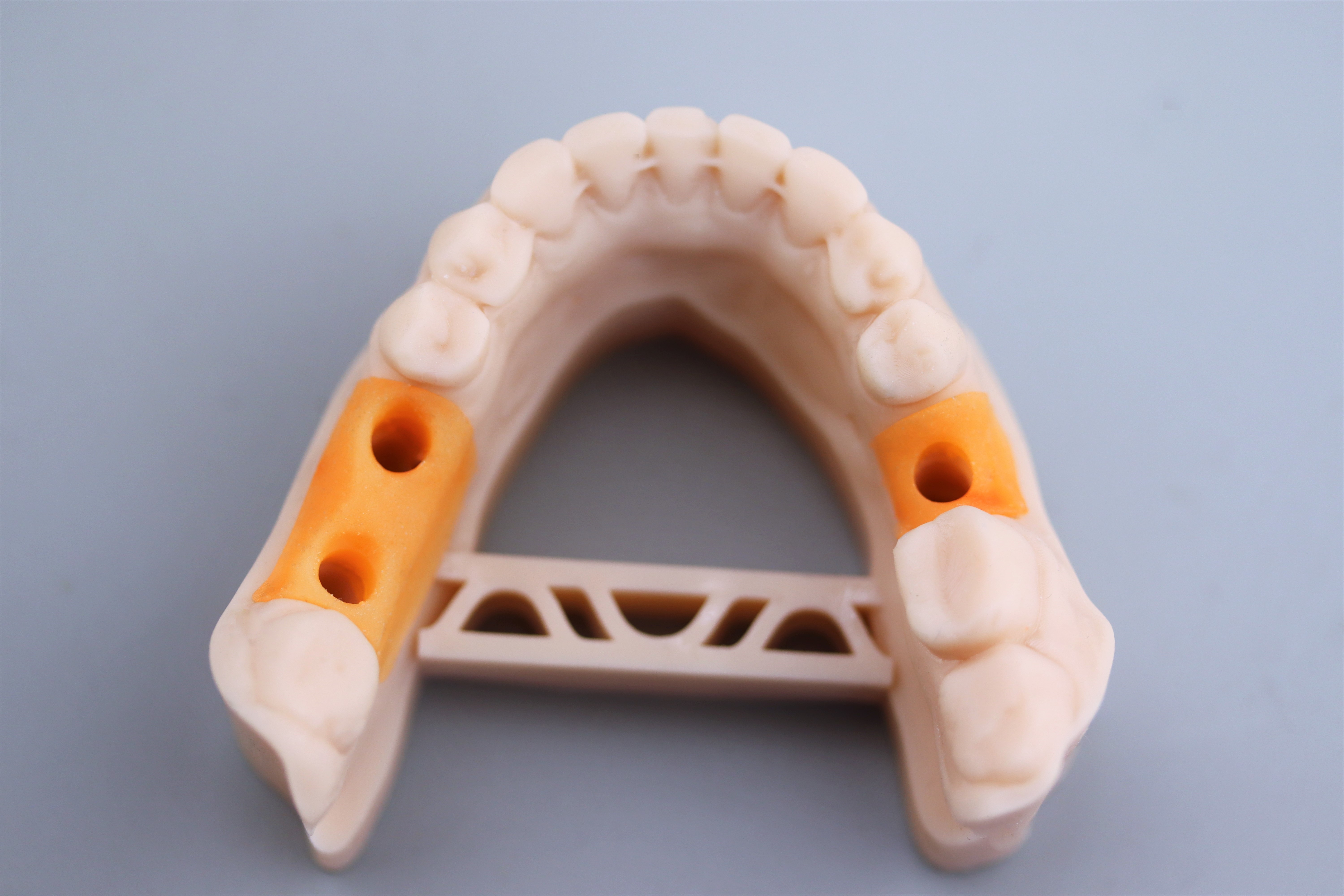 Применение 3D-печати в стоматологии