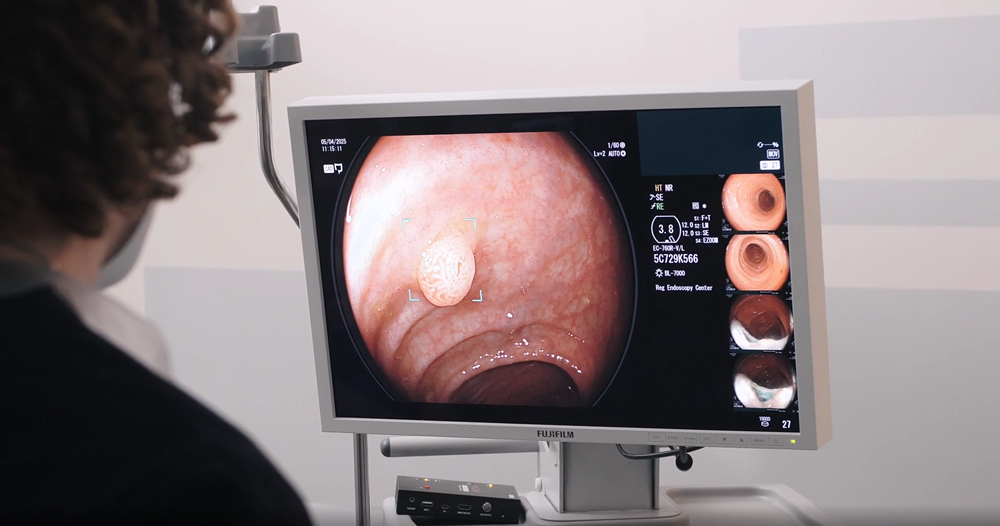 Увидеть, что скрыто: как и зачем проводится эндоскопическая диагностика