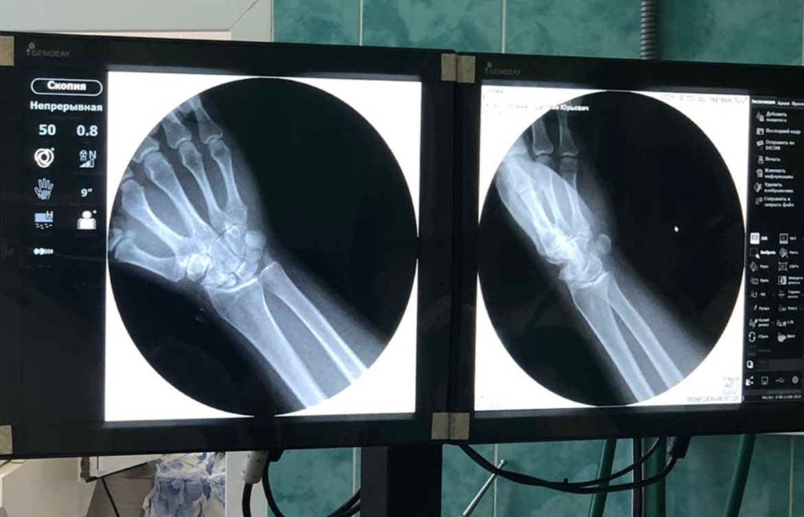 В больнице Березников запустили в работу цифровой рентгеновский аппарат