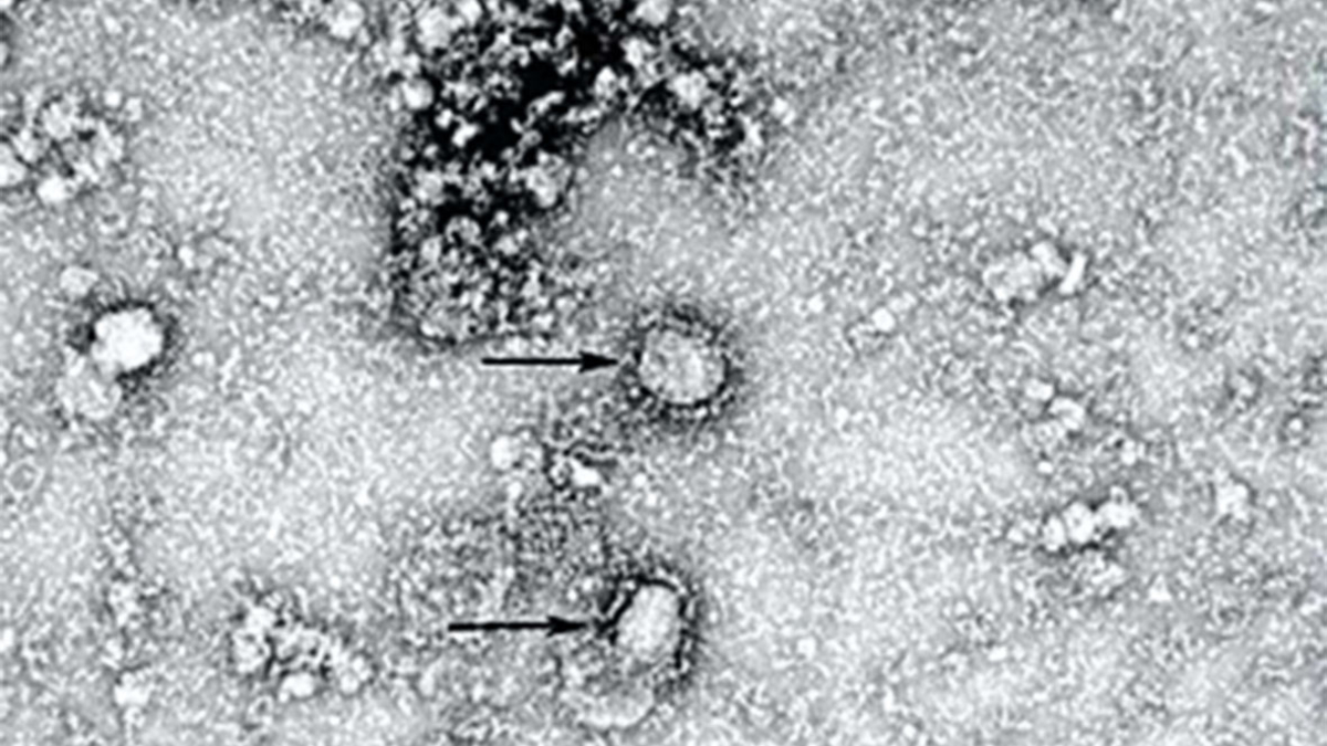 Как выглядят вирусы под микроскопом фото
