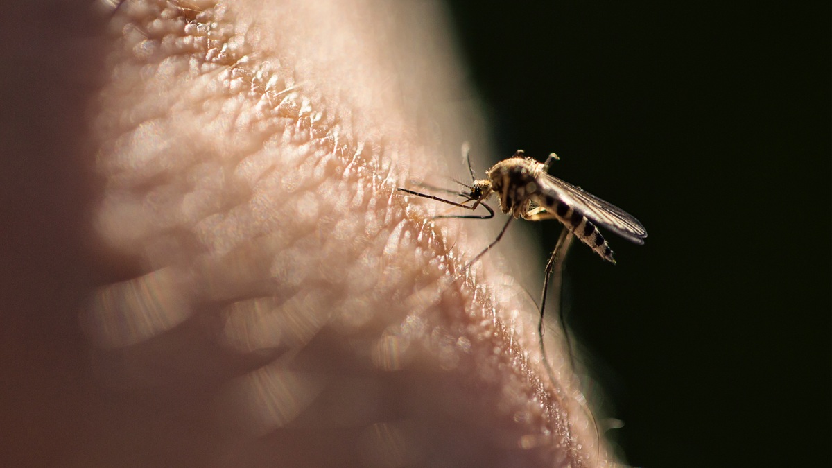 Домашние средства от укуса комара: зуд снимет как рукой | , ИноСМИ