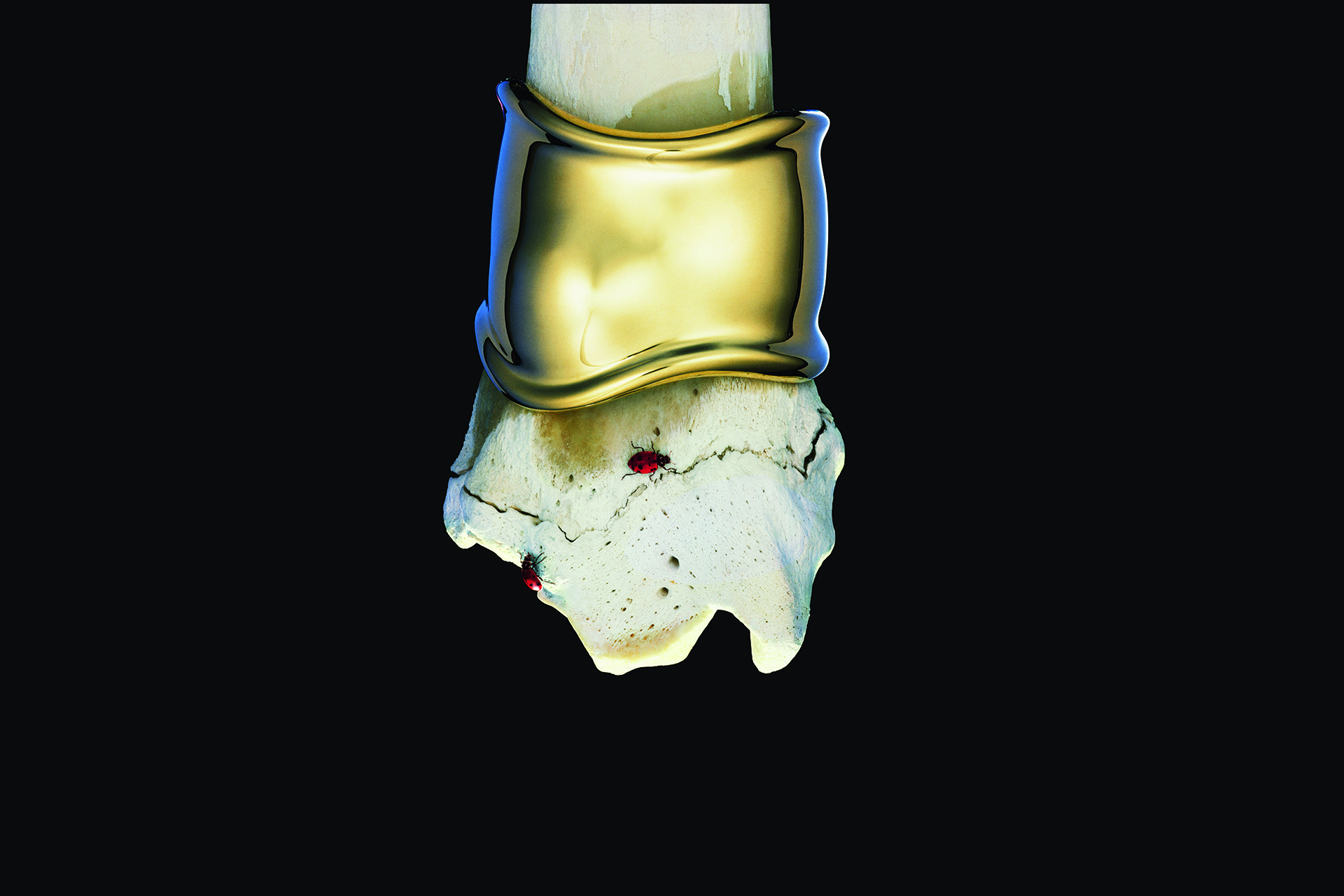 Рекламный снимок браслета Bone, 1980-е