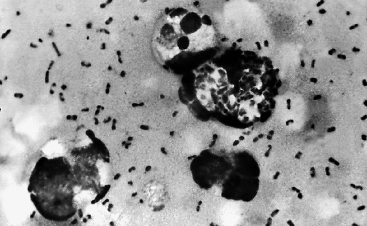 Centers for Disease Control and Prevention / Getty Images