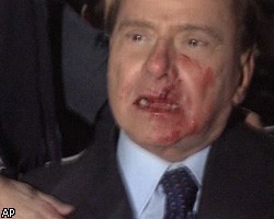 С.Берлускони разбили лицо и сломали нос