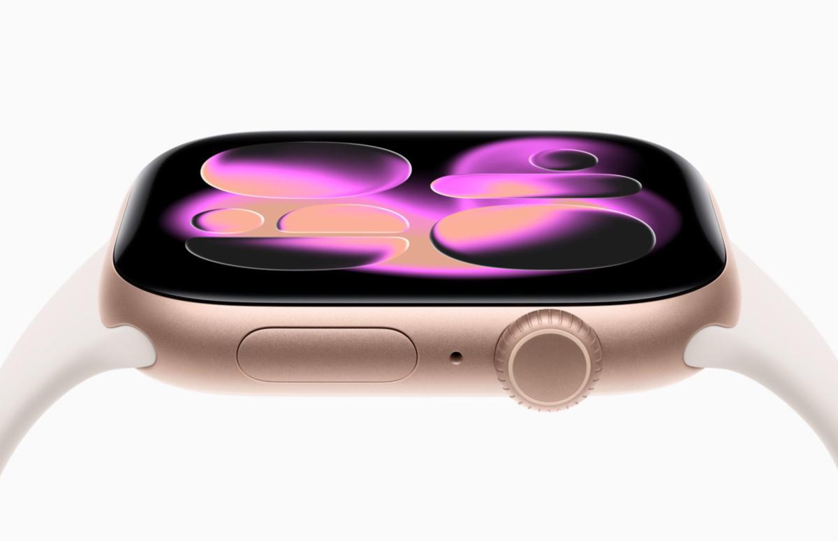 Apple Watch Series 11