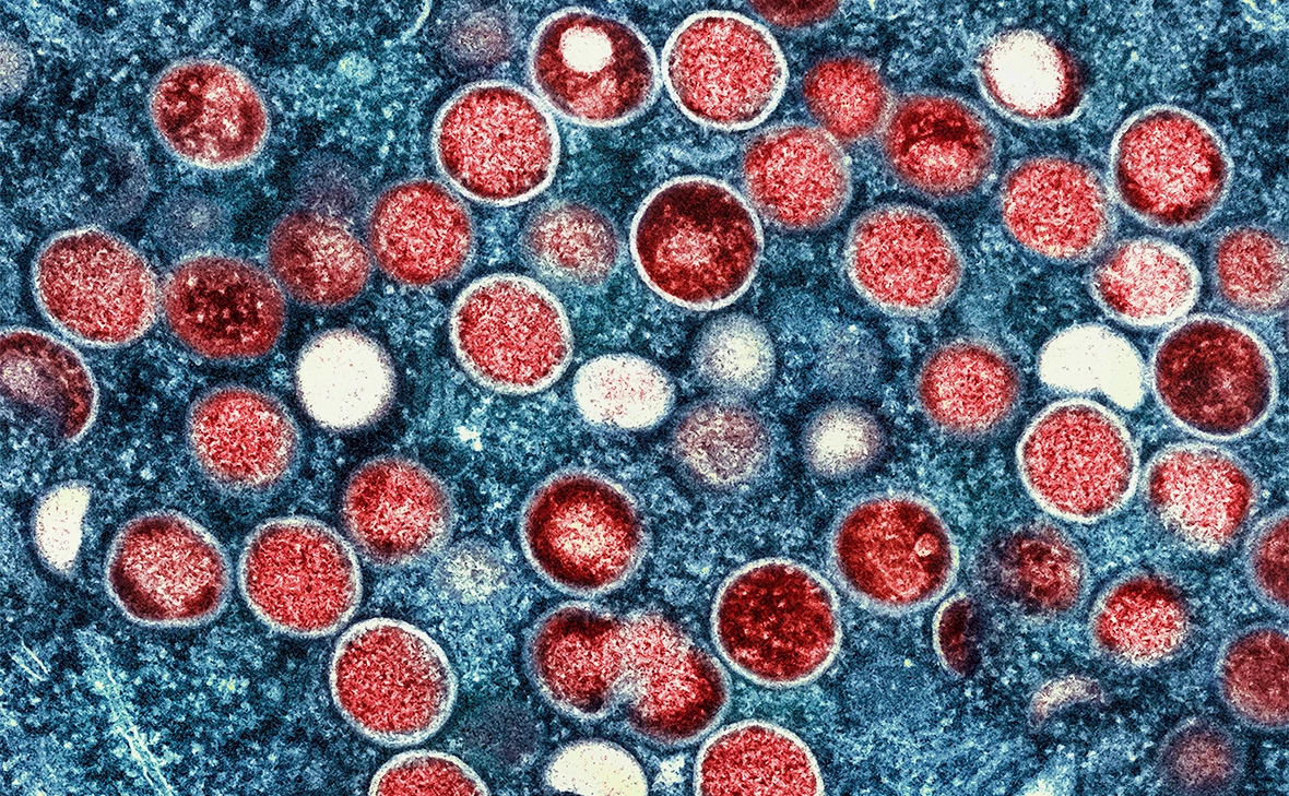 Niaid / Global Look Press