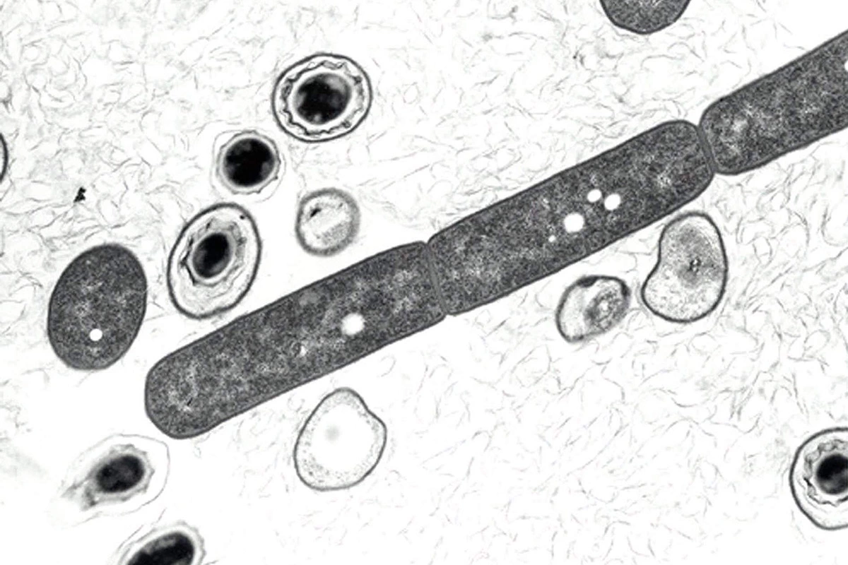 Споры Bacillus anthracis, вызывающие заболевание сибирской язвой