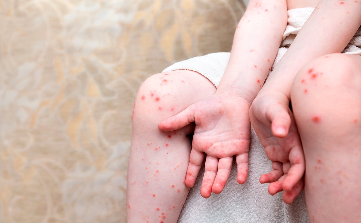 Кобзев Дмитрий / Shutterstock