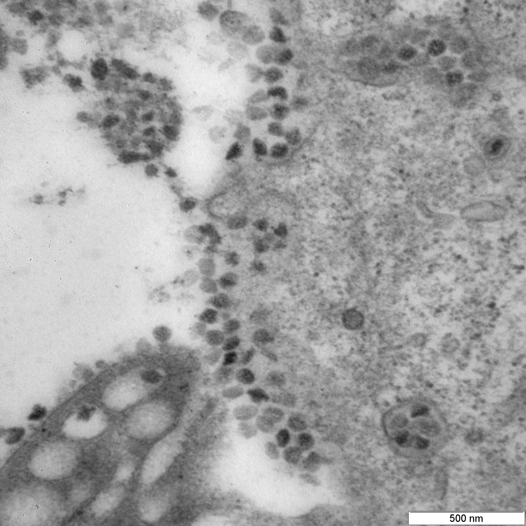 Вирусы &laquo;омикрон-штамма&raquo;, вышедшие из клетки и собравшиеся на ее поверхности.

&nbsp;