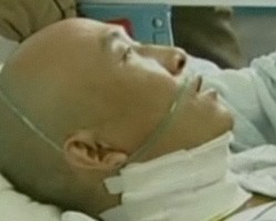 Китаец четыре года испытывал недомогание из-за ножа в голове