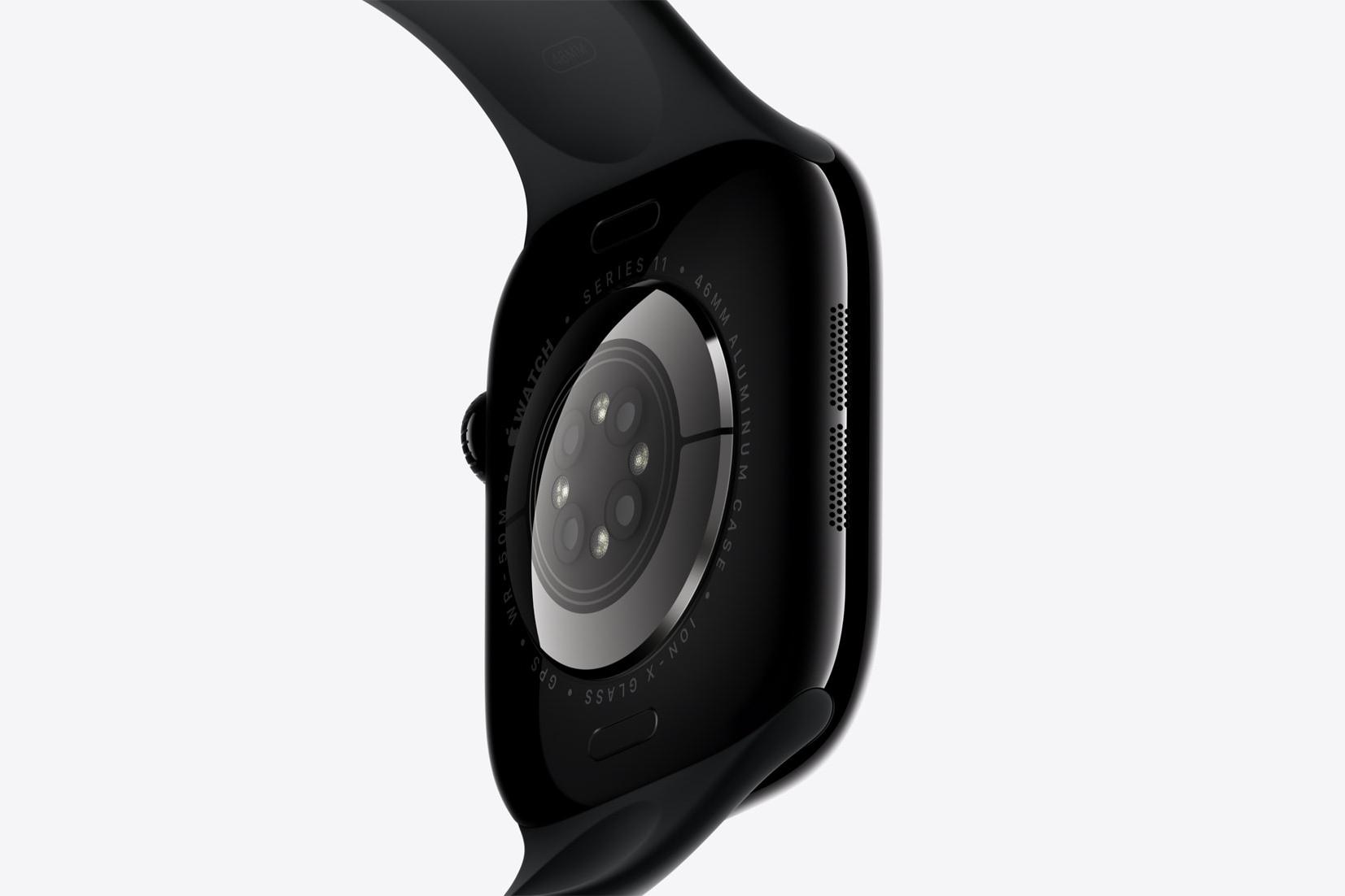 Apple Watch Series 11
