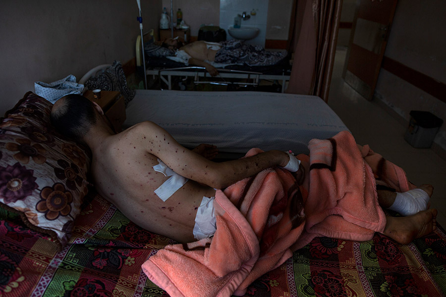 33-летний житель cектора Газа лежит в больнице с ранениями, полученными в результате обстрелов со стороны Израиля, 13 мая.&nbsp;

Израильская армия 13 мая отчиталась об атаке на более 600 военных объектов ХАМАС&nbsp;в секторе Газа. По данным Al Jazeera, жертвами ударов стали 119 человек, в том числе 31 ребенок. Более 830 получили ранения