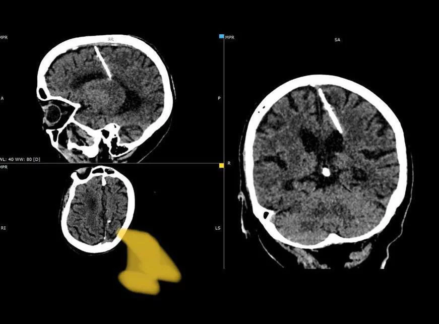 Минздрав Сахалинской области
