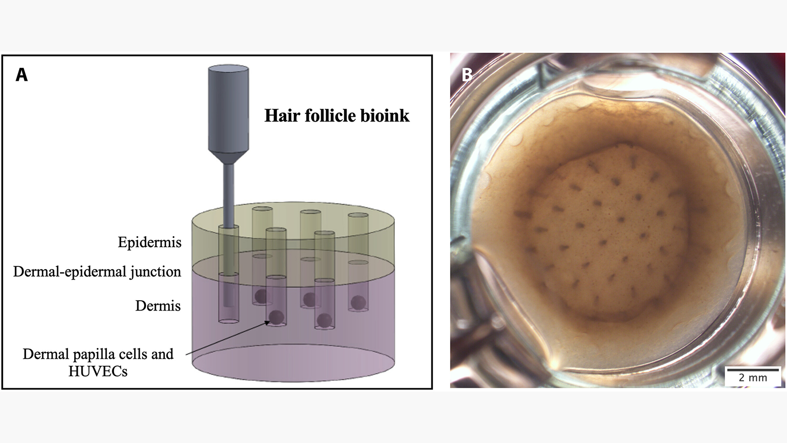 <p>3D-биопечать волосяных фолликулов внутри кожи</p>
