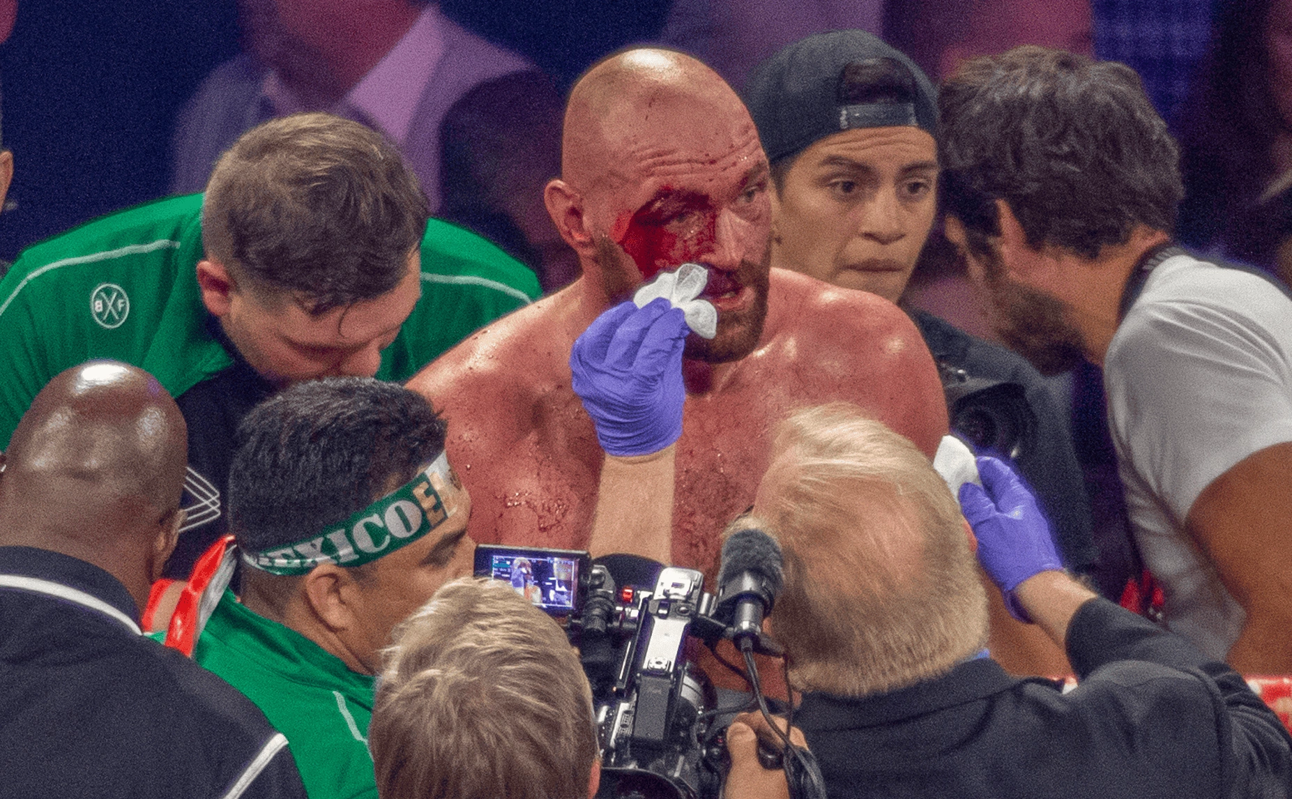 Larry Burton / Global look press