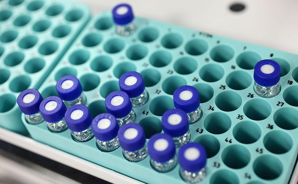 Фото: Oli Scarff / Getty Images