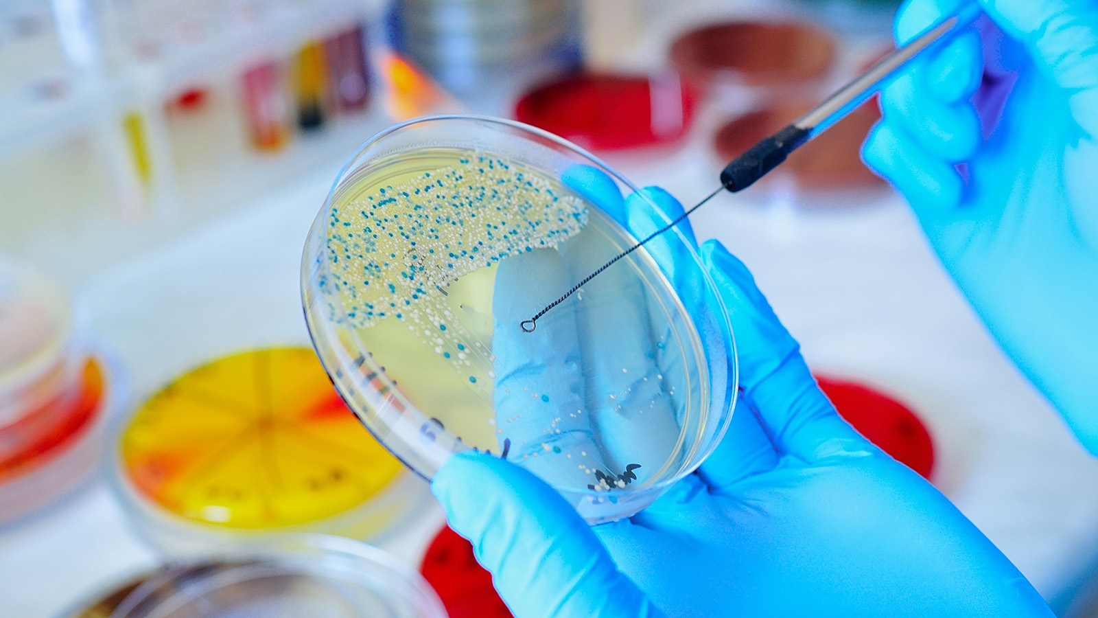 Curiosidades de la microbiología: 2013