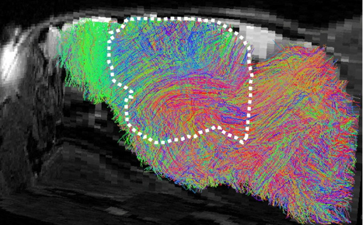 Segiu Pascu Lab / Stanford Univers / Reuters