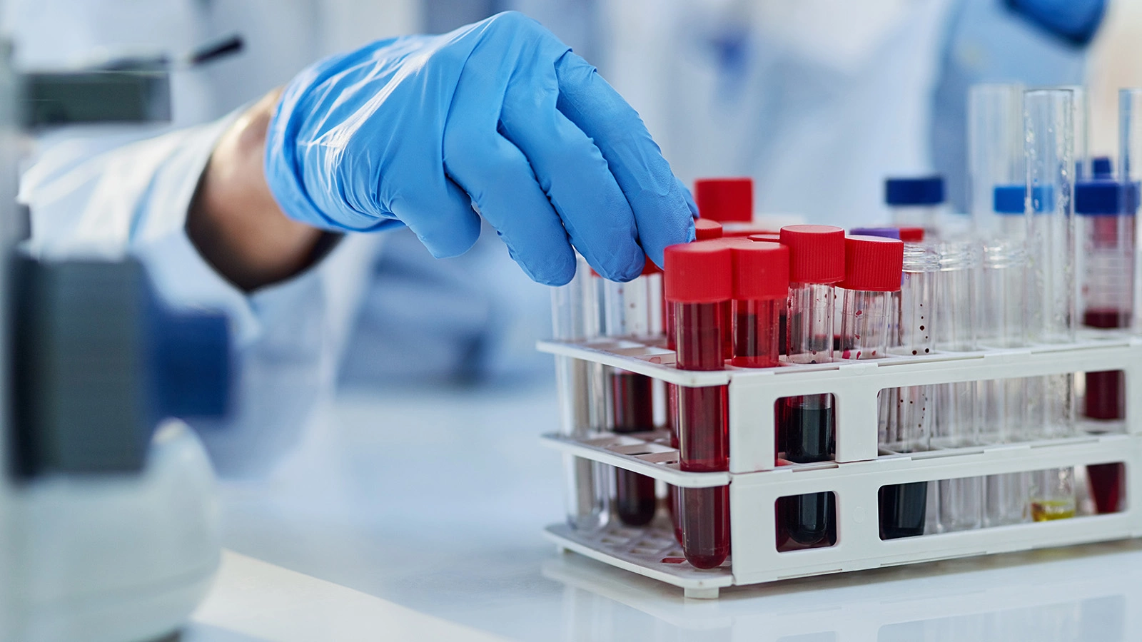 В России изменились правила освидетельствования на ВИЧ. Это важно