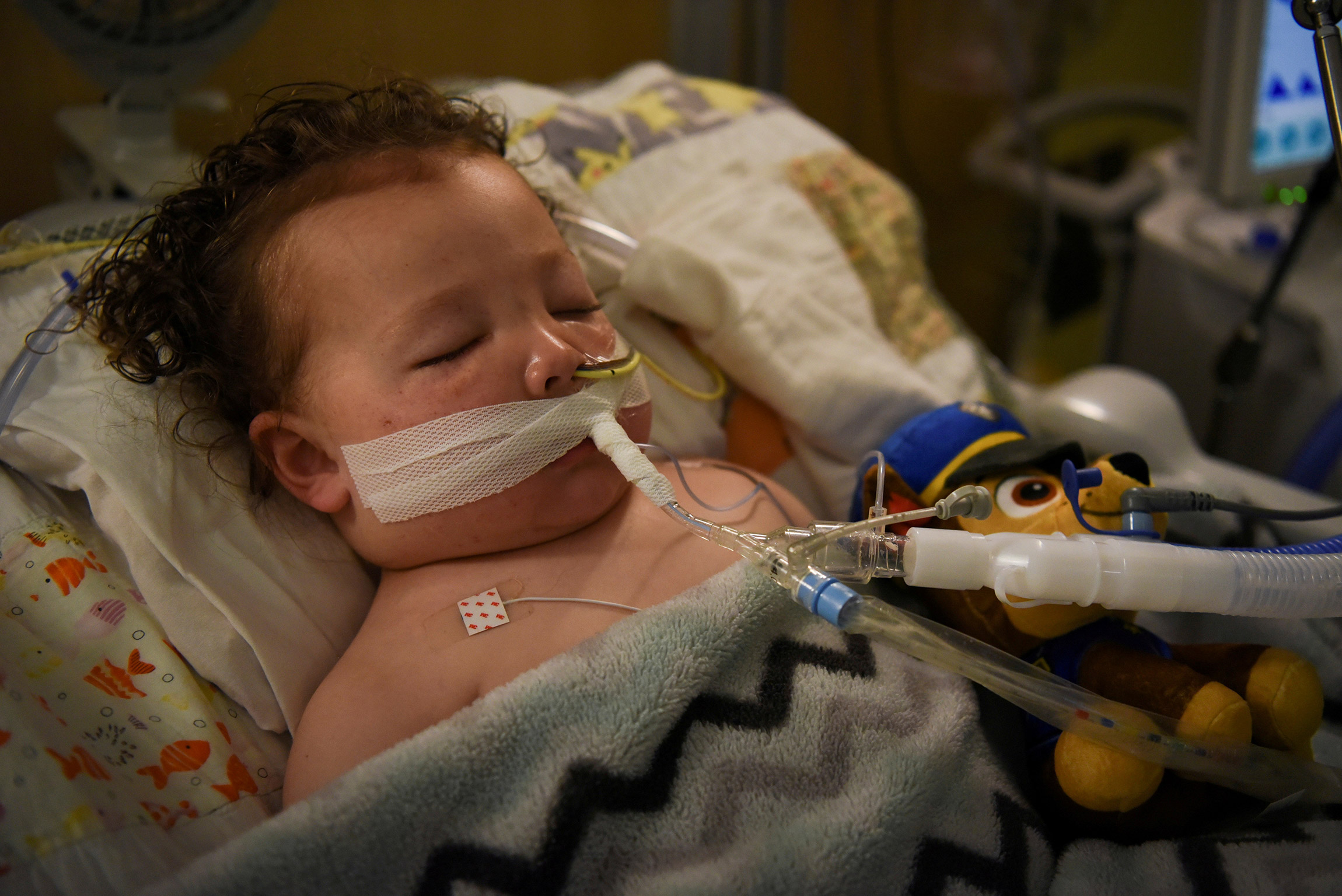 5 октября. Сент-Луис, США. Двухлетний ребенок с COVID-19 на аппарате искусственной вентиляции легких