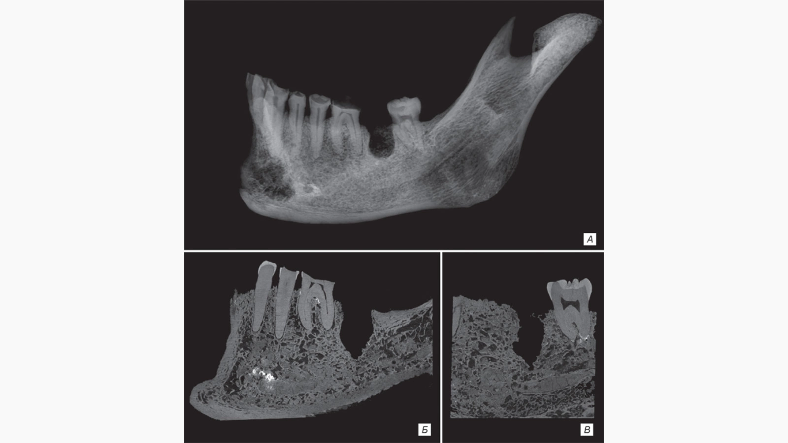 <p>На фото: рентгенография челюсти, найденной в Северо-Минусинской впадине</p>