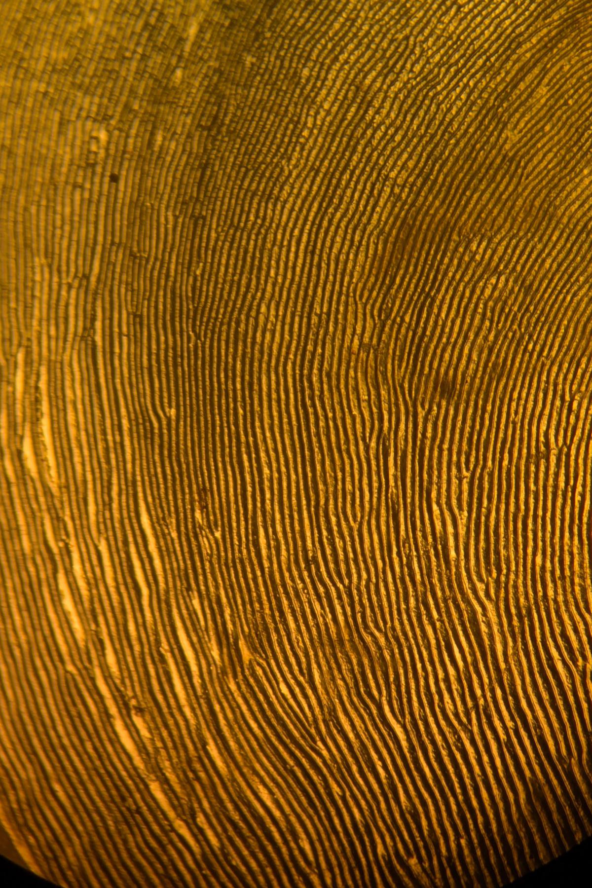 Часть структуры дермы составляют коллагеновые волокна. Это та самая «сетчатая основа», которая дает коже упругость