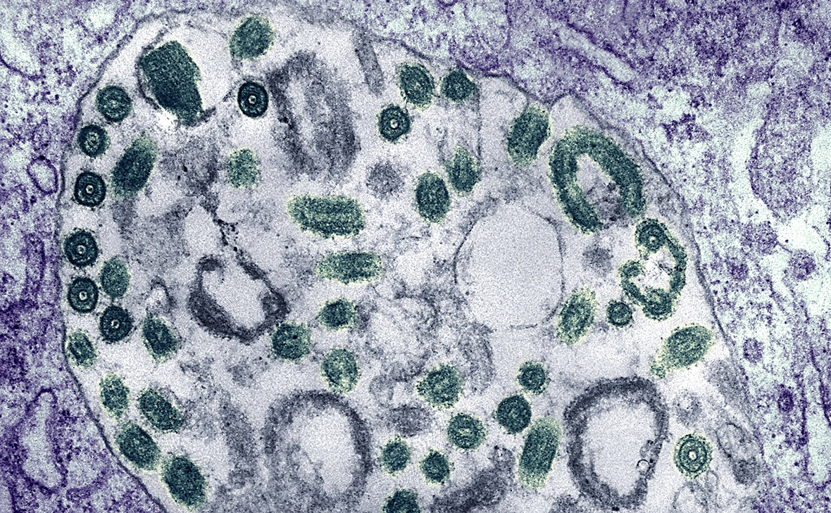 IMAGO / CDC / IMAGE POINT FR / BSI / Global Look Press