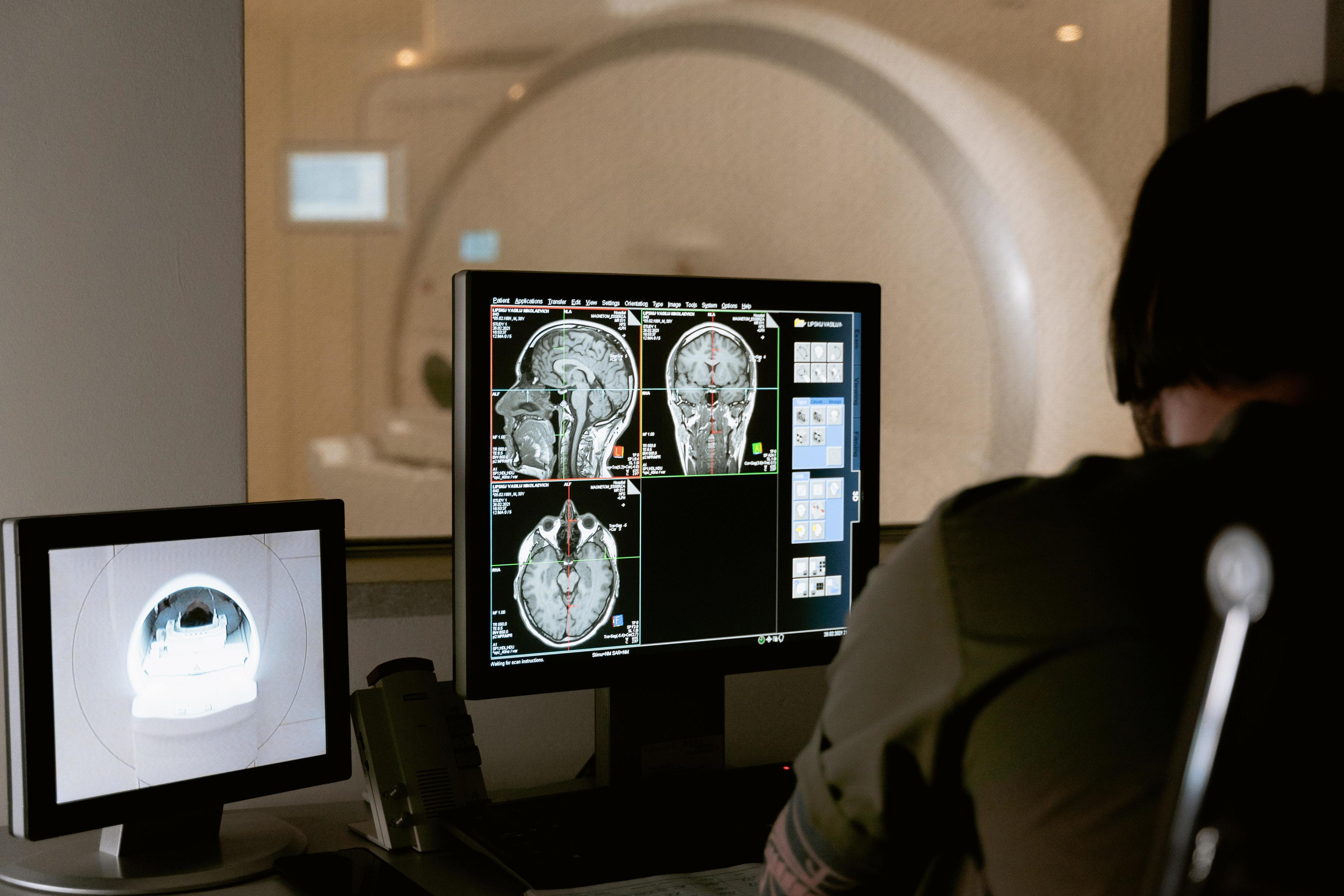 В процессе исследования О&#39;Коннор использовал функциональное МРТ-сканирование, чтобы понять, какие отделы мозга активизируются во время ощущения дежавю.