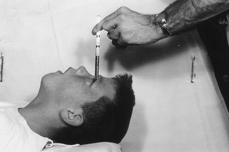12-летний Говард Далли во время трансорбитальной лоботомии в 1960 году