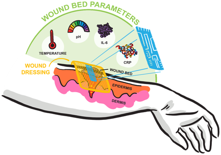 Визуальное представление того, как система гибких датчиков будет размещаться на руке