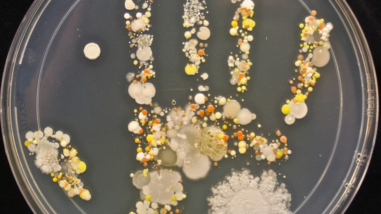 Отпечаток ладони на поверхности чашки Петри &mdash; работа микробиолога Таши Штурм.