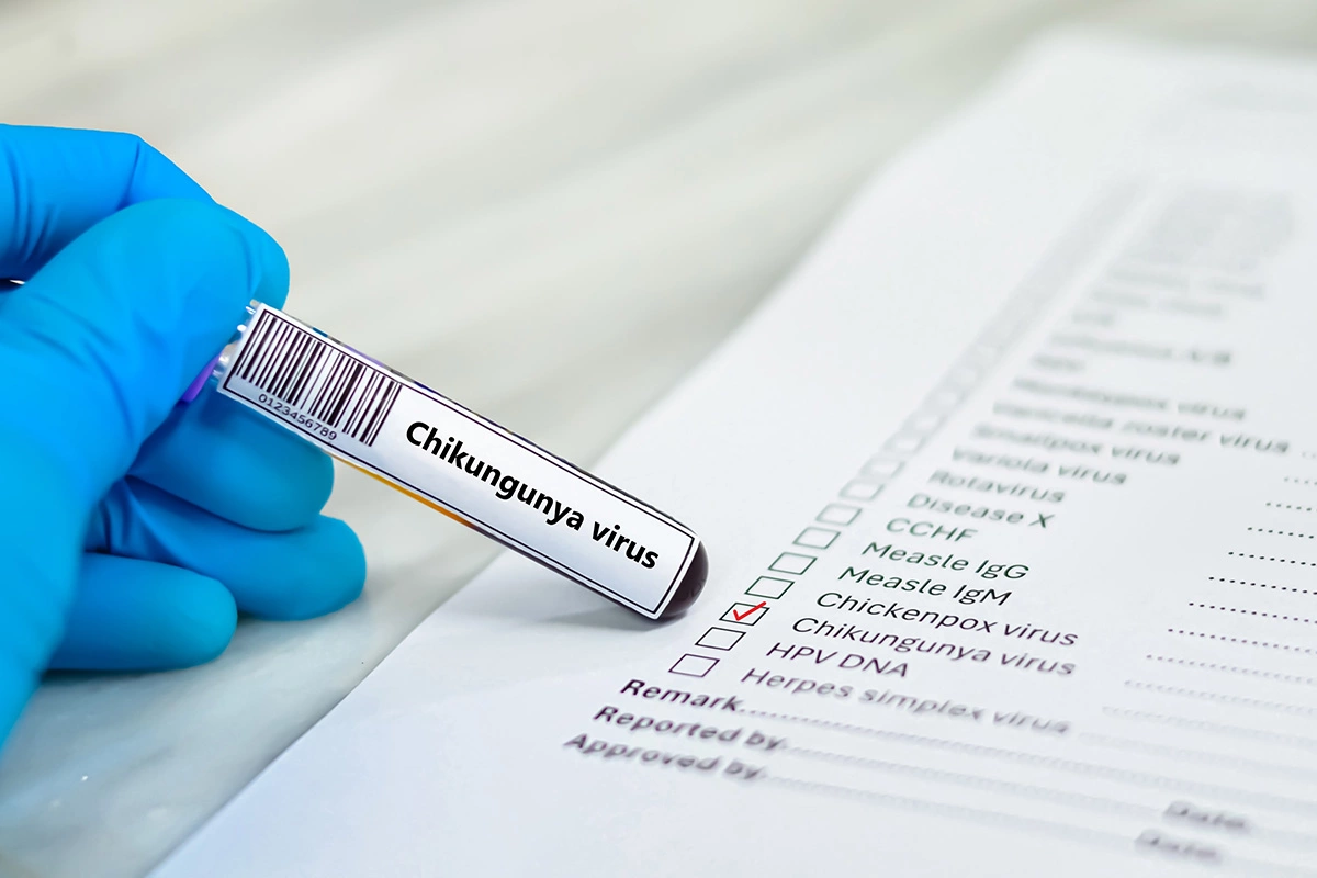 Лихорадка чикунгунья: в чем опасность и как лечить