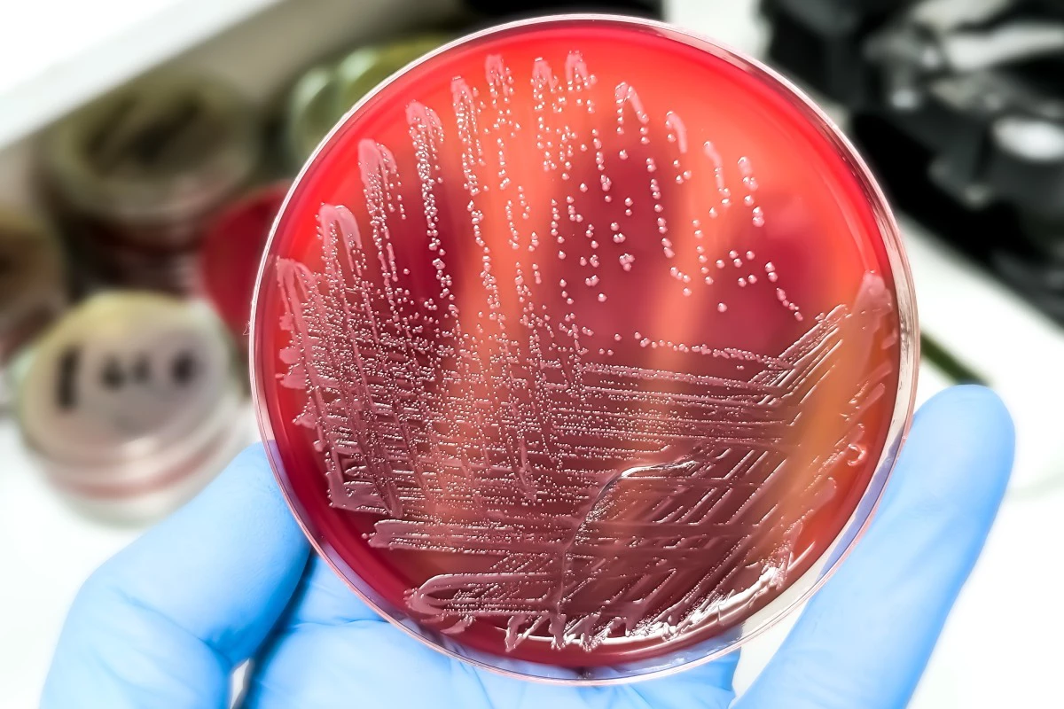 Определить наличие сальмонеллы на глаз невозможно, предупреждают эксперты