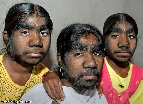 В Индии нашли семейство "оборотней"
