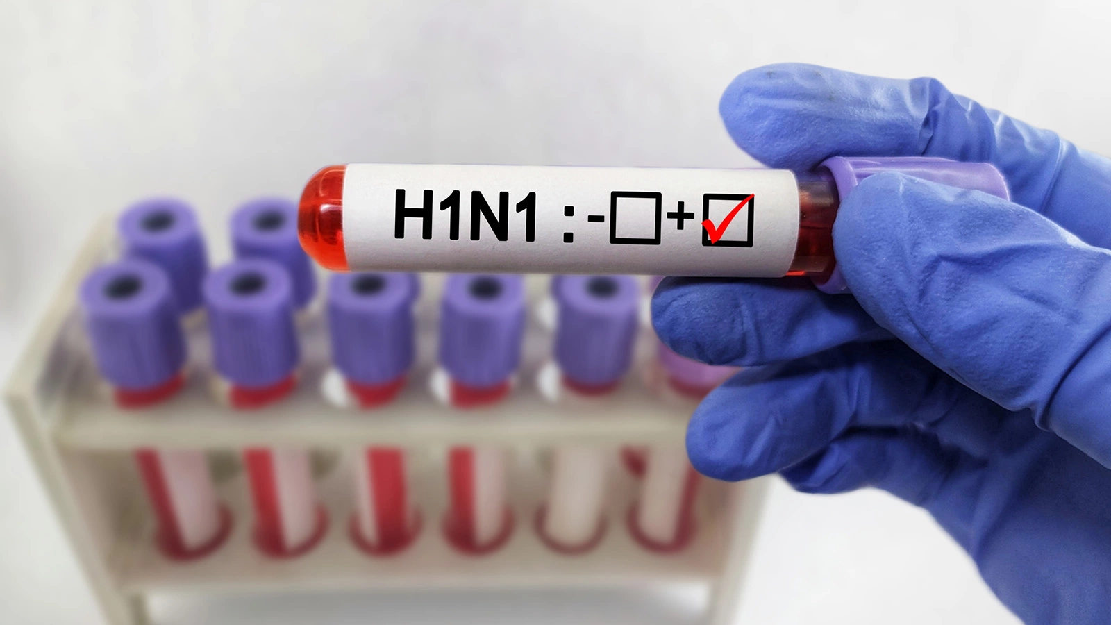 Будет ли новая волна свиного гриппа весной. Мы все узнали