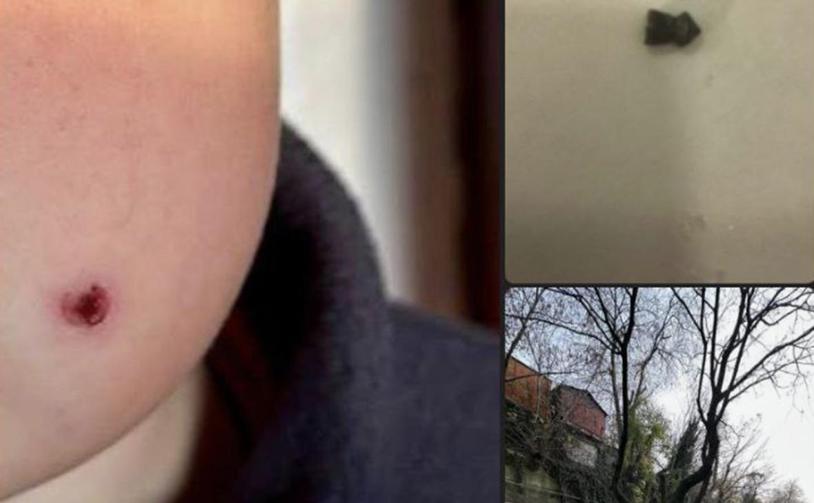 V Tuapseju neznan strelec ustrelil devetletnega otroka