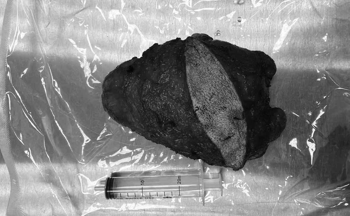 пресс-служба Минздрава Московской области