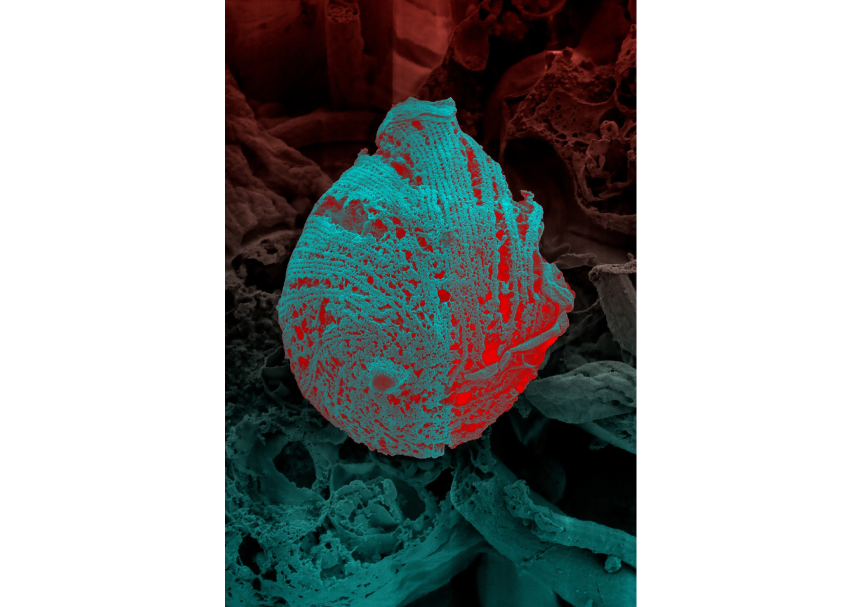 Триатомовый клоп