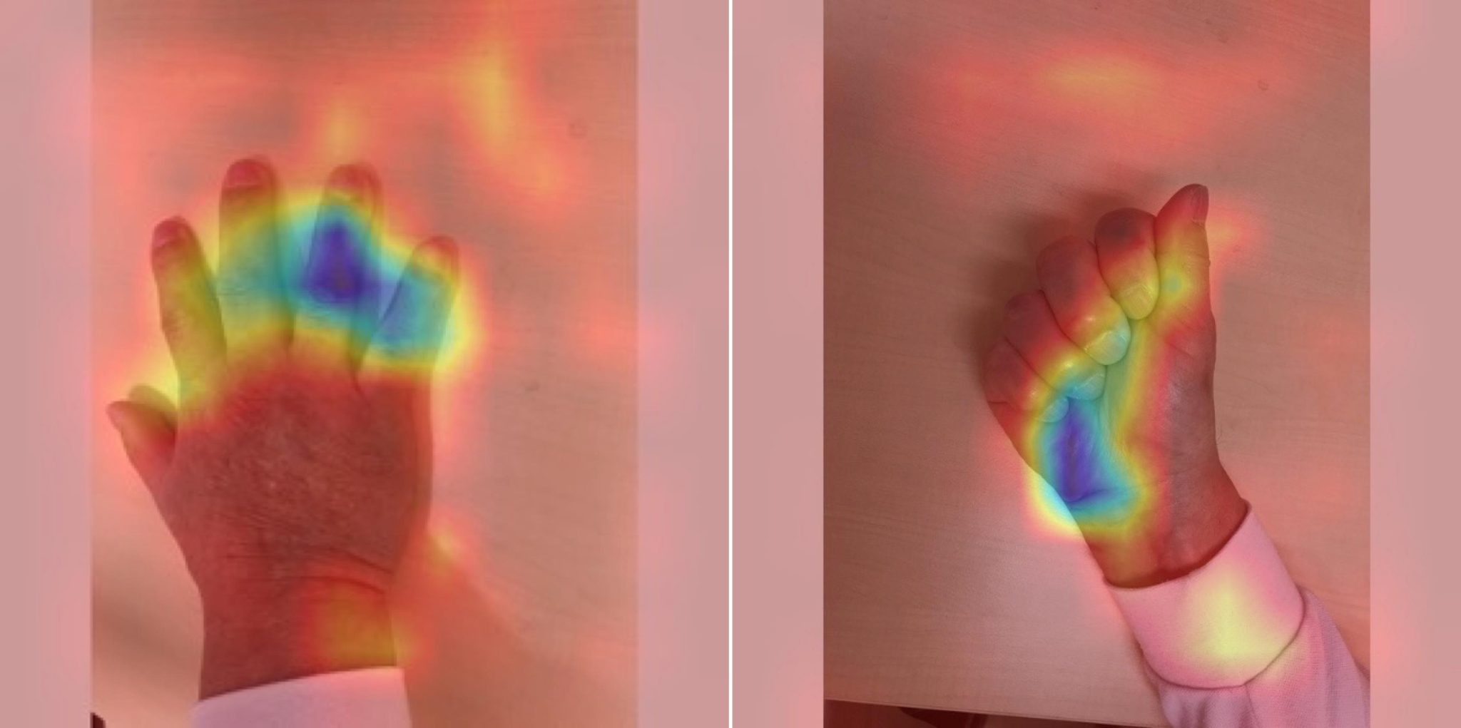 Так выглядят снимки, которые собираются для обучения модели и диагностики