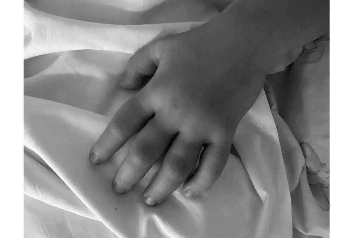 Женщину спасли после укуса гадюки. Объясняем, что делать в таких случаях