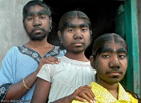 В Индии нашли семейство "оборотней"
