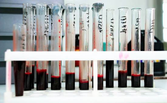 В лаборатории, где&nbsp;исследуют кровь на&nbsp;наличие ВИЧ


