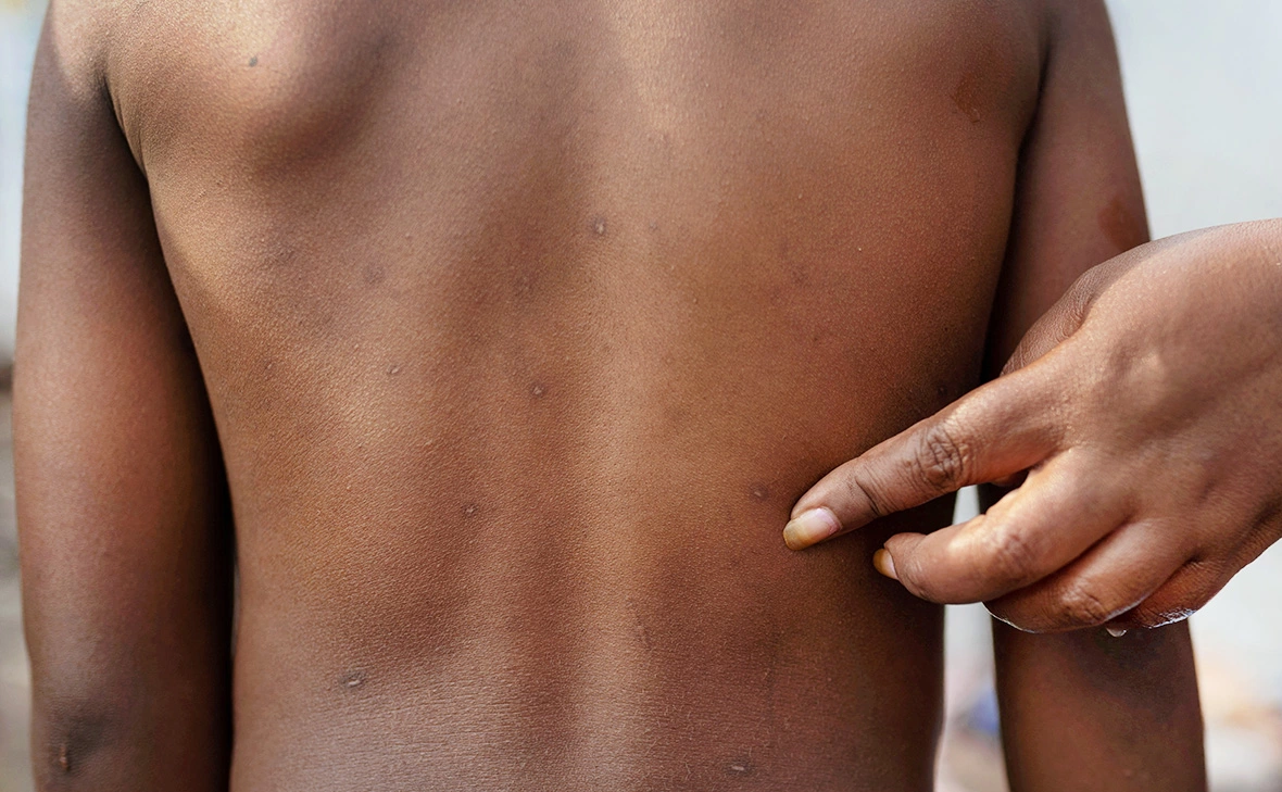 Arlette Bashizi / Reuters