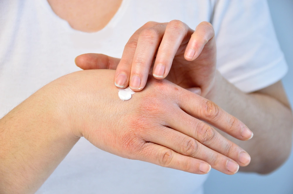 Цыпки на руках: причины появления и способы лечения | Аргументы и Факты