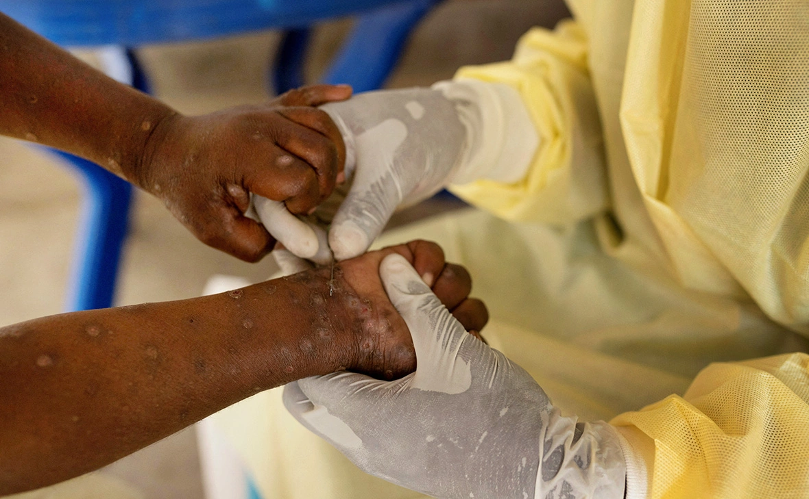 Arlette Bashizi / Reuters