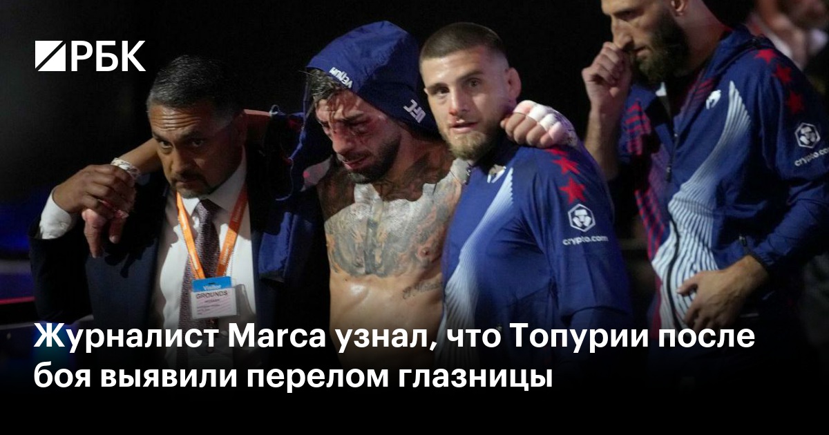 Журналист Marca узнал, что Топурии после боя выявили перелом глазницы