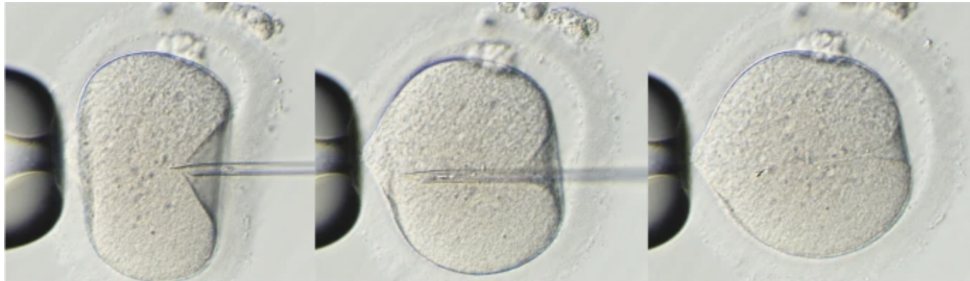 Процесс введения одного сперматозоида в яйцеклетку