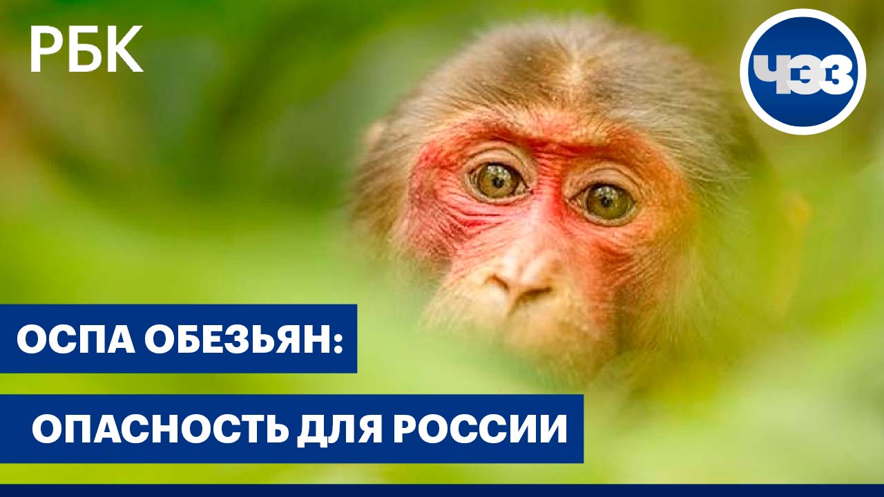 Оспа обезьян: есть ли опасность для России