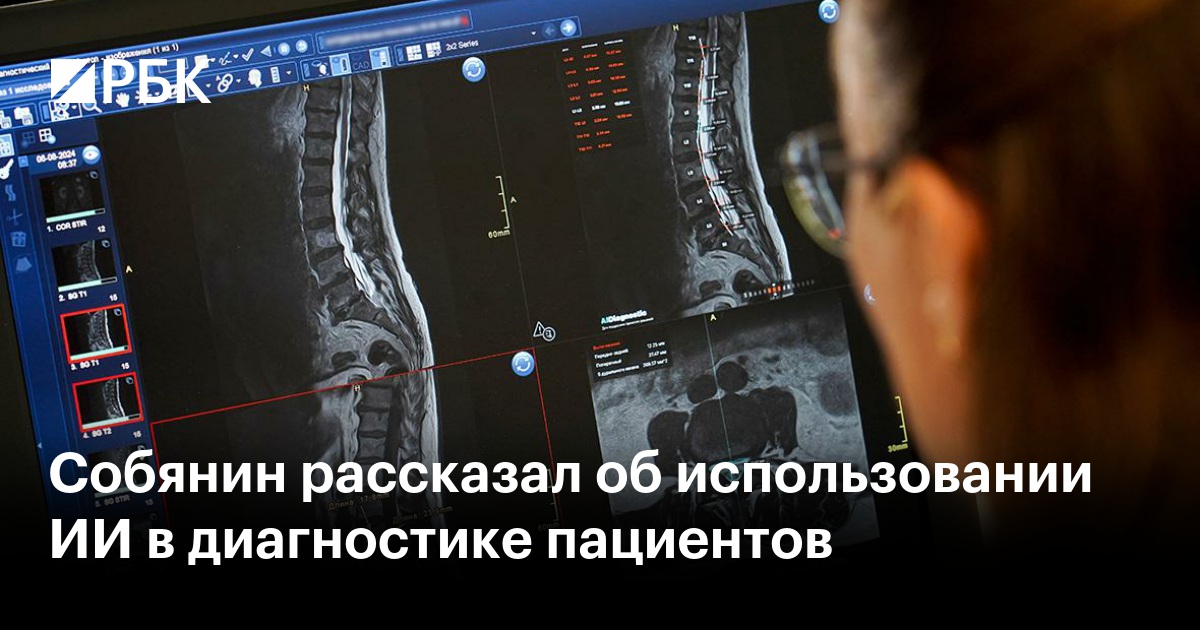 Собянин рассказал об использовании ИИ в диагностике пациентов